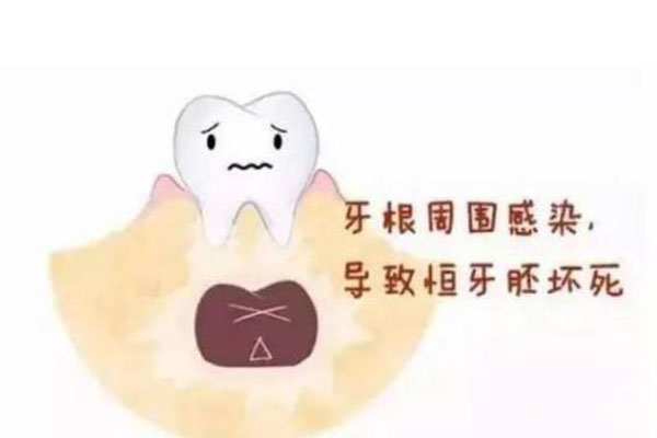 儿童根尖炎牙龈上有个包怎么治疗最好呢(儿童根尖炎牙龈上有个包怎么治疗最