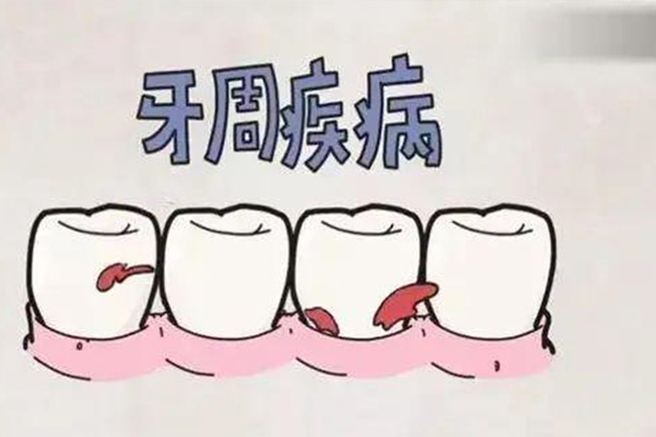 牙周炎治不好能戴牙冠吗多少钱(牙周炎治不好能戴牙冠吗多少钱一个)