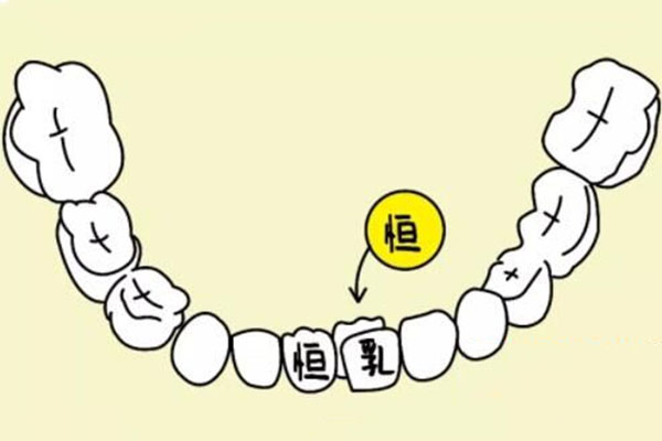 根尖炎中药治疗方法(根尖炎中药治疗方法)