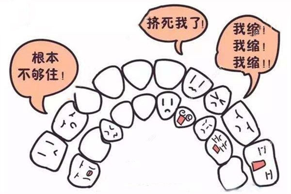 牙齿拥挤矫正多久可以排齐(牙齿拥挤
