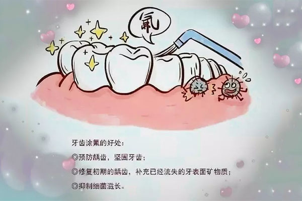 小孩牙齿需要涂氟吗,多少费用一颗牙(小孩牙齿要涂氟吗?)