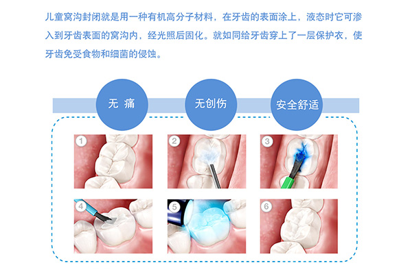 涂氟对牙齿有什么好处多久涂一次(涂氟对牙齿有什么副作用)