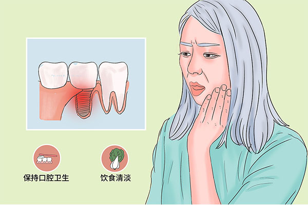 大人牙痛快速止痛方法吃什么药好(大人牙疼快速止疼方法)