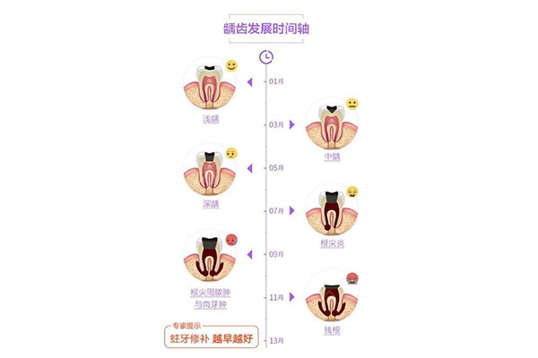 虫牙照片严重(虫牙照片是什么样子的)