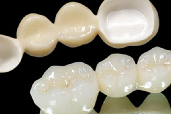 牙冠护理(牙冠的基本步骤护士准备)