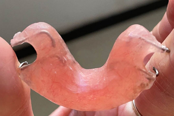 流体树脂充填医保项目怎么填(流体树脂充填医保项目怎么填的)