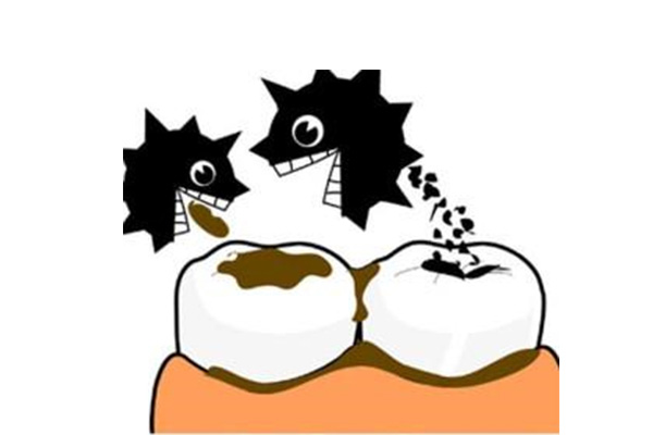 小儿蛀牙疼痛难忍怎么办呀用什么药(小儿蛀牙疼痛难忍怎么办呀用什么药治疗