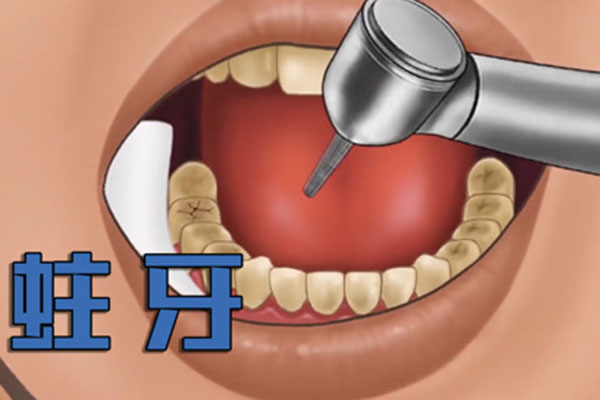 8岁小孩蛀牙牙疼怎么办(8岁小孩蛀牙牙疼怎么办呀)