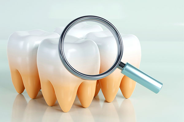 牙根尖炎最好的治疗方法有哪些药水(牙根尖炎最好的治疗方法有哪些药水图片