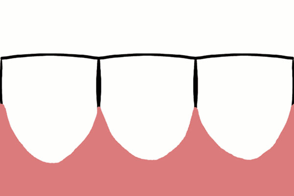 牙体缺损修复时,可增加修复体抗力(牙体缺损修复时,可增加修复体抗力除了)