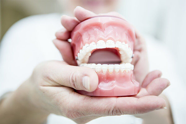 树脂固定牙齿多久去除(树脂固定牙齿多久去除一次)