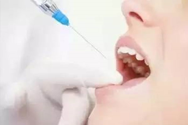 龋齿根管治疗是什么手术(龋齿根管治疗是什么手术啊)