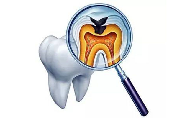 脱敏治疗牙齿的适应症(脱敏治疗牙齿的适应症和禁忌症)