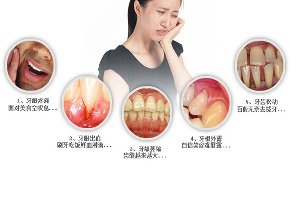 牙根尖炎直接拔掉好吗多少钱一颗(牙根尖炎拔掉能好吗)