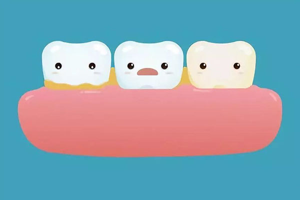 牙齿发黄怎么去除变白牙膏小妙招(牙齿发黄怎么去除变白牙膏小妙招视频)