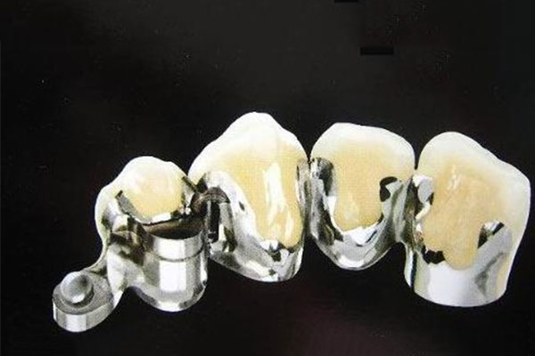 修牙需要注意什么事项和饮食(修牙期间注意什么)