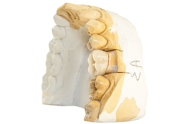 孩子修牙打麻药有什么副作用吗(儿童修牙打多少麻药对人体的伤害)