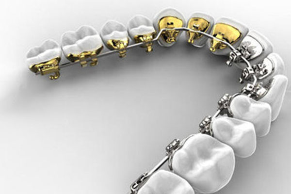 打呼噜下颌前移(打呼噜下颌前移怎么治疗)