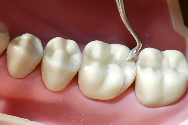 喝茶牙齿发黄怎么去除啊(喝茶牙齿发黄怎么去除啊视频)