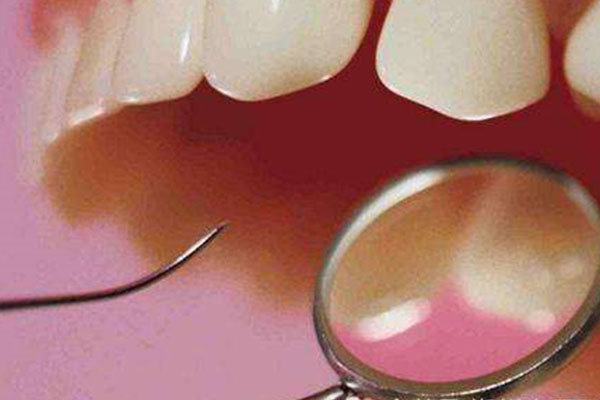 烟黄牙用什么可以刷干净一点呢(烟黄牙用什么可以刷干净一点呢视频)