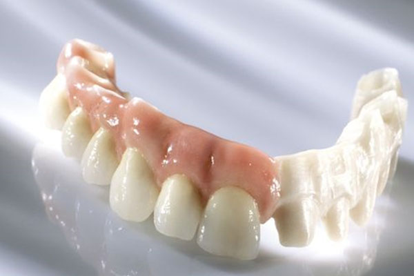 复合树脂类充填牙齿(复合树脂类充填牙齿多少钱)