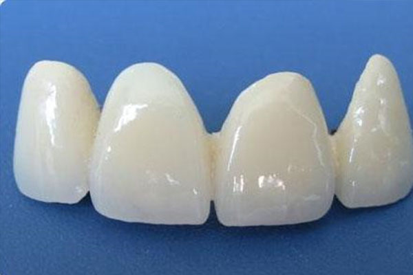 瓷贴面是用什么材料做的好(瓷贴面是用什么材料做的好一点)