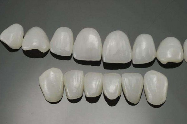全冠牙和牙贴面哪个好一点(全冠牙和牙贴面哪个牢固)