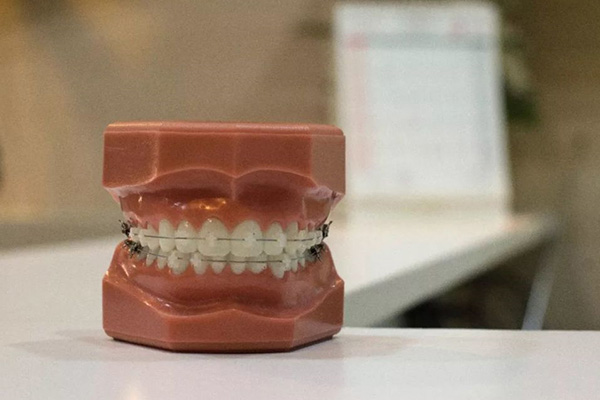 南光树脂胶水是正品吗(南光树脂胶水是正品吗能用吗)