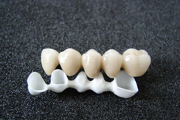 做牙齿贴面制作过程!(做牙齿贴面制作过程图片)