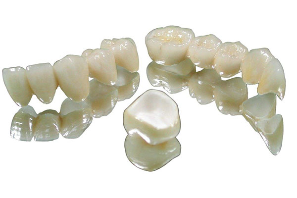 牙冠 材料 (牙冠材料)