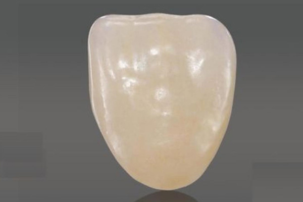 做瓷贴面一般多少钱一次啊(做瓷贴面一般多少钱一次啊)