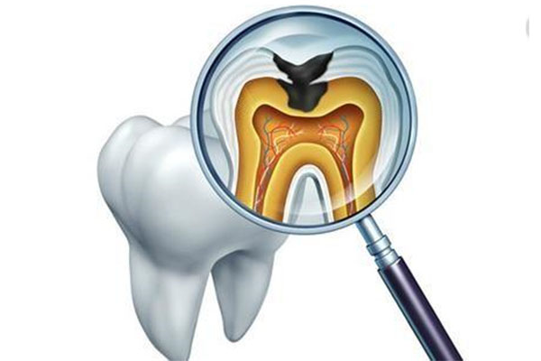 简述牙体缺损修复体的种类(牙体缺损修复体的类型有哪些)