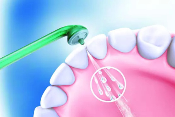 洁牙后多久吃饭最好(洁牙后多久吃饭最好吃)