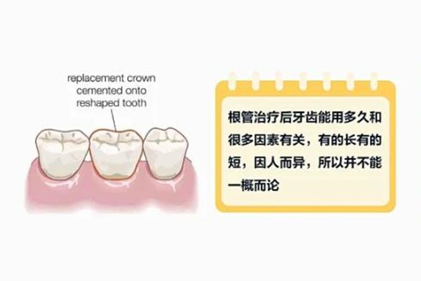 二次根管治疗要慎重(二次根管治疗要慎重填洞的东西有刺鼻的味道)