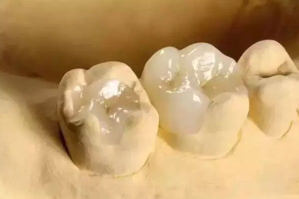 牙本质过敏牙疼(牙本质过敏牙疼吃什么药)