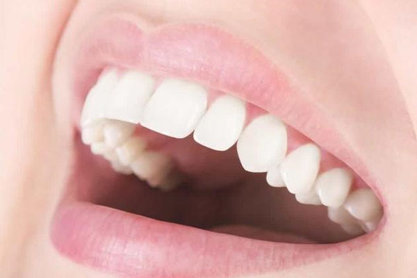 牙齿上有黑线正常吗(牙齿上有黑线正常吗)