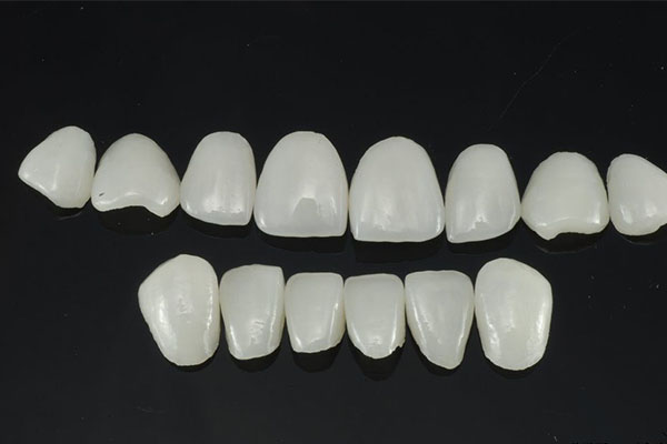 琥珀瓷牙贴面的优缺点有哪些呢(琥珀瓷牙贴面的优缺点有哪些呢视频)