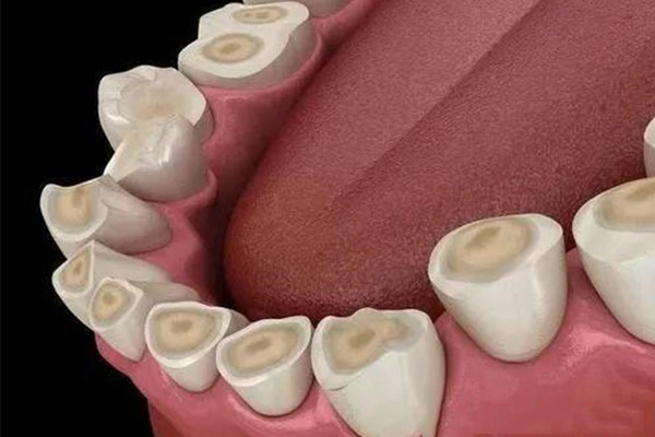 牙齿表面缺损一小块怎么修复好(牙齿表面缺损一小块怎么修复好得快)