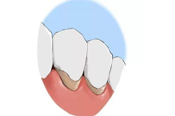 喝茶牙齿黄了怎么变白最简单的方法是(喝茶牙齿发黄怎么去除变白)