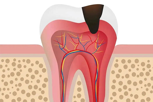 牙体缺损修复的基本工作流程包括哪些(牙体缺损修复的基本工作流程包括哪些