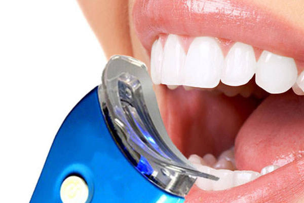 牙齿去烟渍的牙膏有哪些品牌(牙齿去烟渍的牙膏有哪些品牌好用)