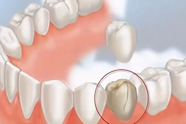 喝茶牙齿黄怎么办呢吃什么药(喝茶牙齿黄怎么办呢吃什么药管用)