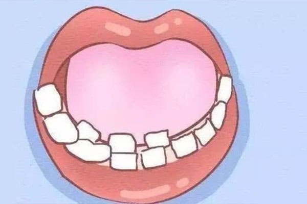 牙齿旁又长了一个小牙怎么办啊(牙齿旁又长了一个小牙怎么办啊吃什么药)