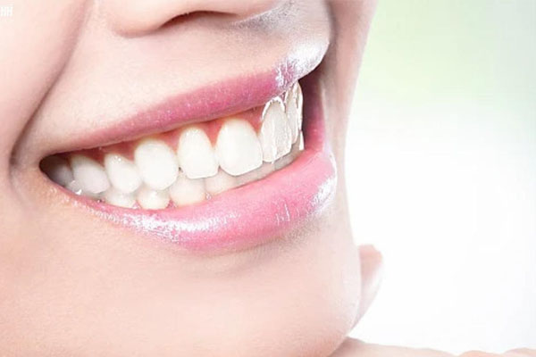 皓得适牙齿美白(皓得适牙齿美白剂)