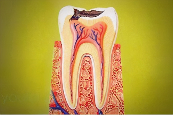 牙齿补了掉了一小块需要重新补吗(牙齿补了掉了一小块需要重新补吗图片)