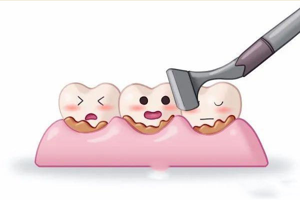 吸烟牙黄用什么牙膏能去掉呢(吸烟牙黄用什么牙膏能去掉呢视频)