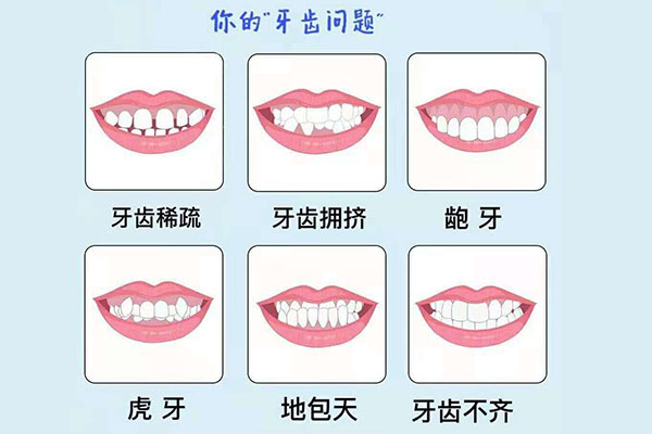 成人牙齿反颌怎么办(成年了反颌还可
