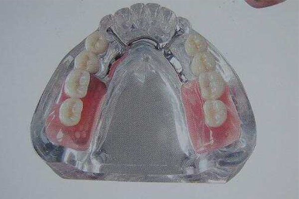 树脂排水沟使用寿命(树脂排水沟使用寿命多久)