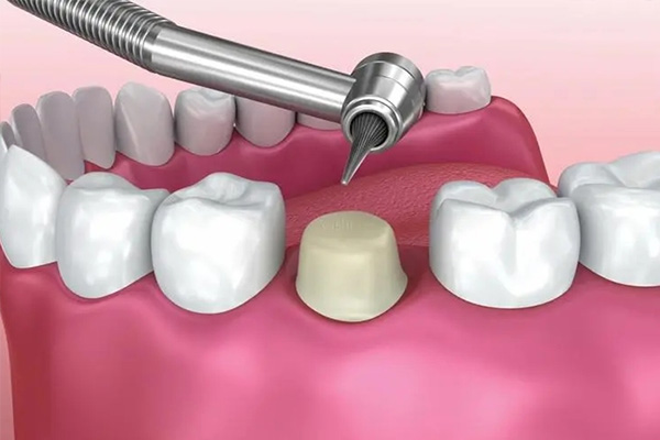 男人牙齿黄是什么原因引起的(男人牙齿黄是什么原因引起的呢)