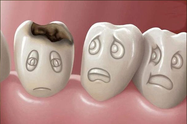 门牙缺损一个角这个牙会坏吗怎么办(门牙缺损一个角这个牙会坏吗怎么办呀)